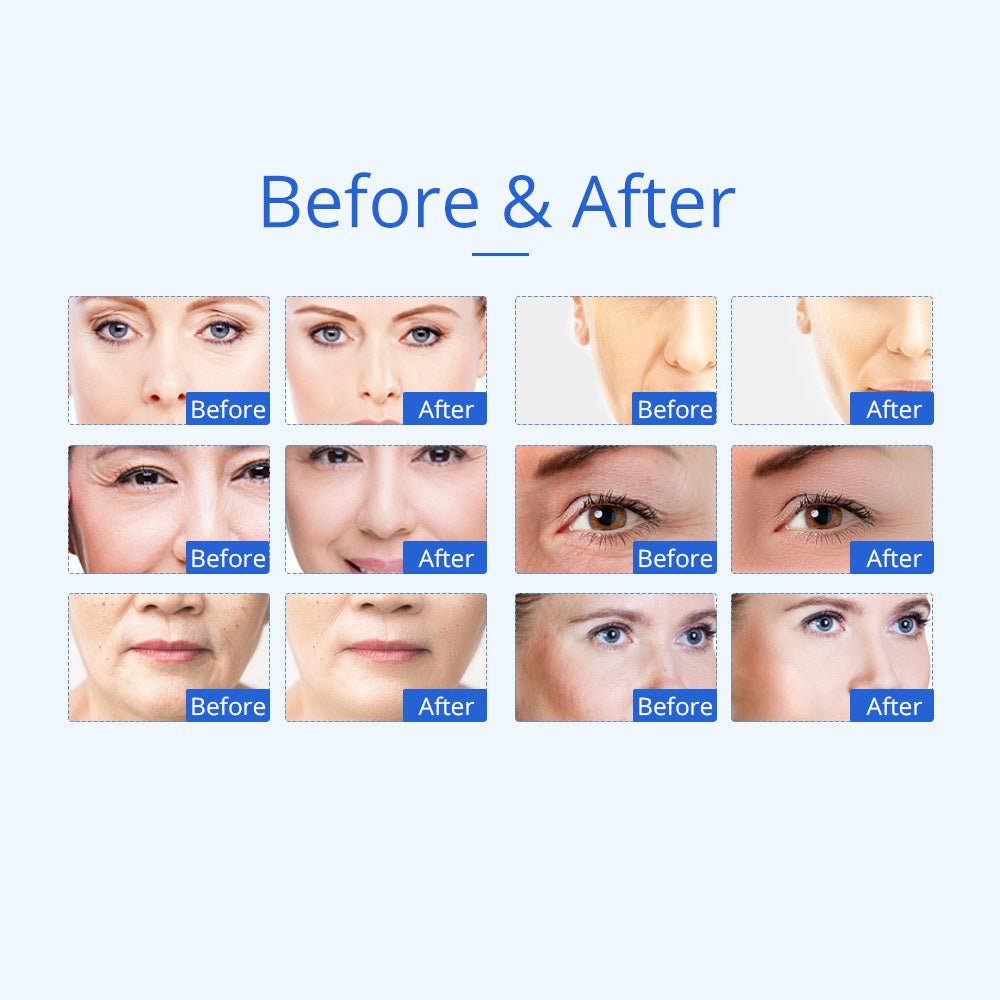 Shape Tactics 8-in-1 Microcurrent RF Cavitation & Laser Contouring System