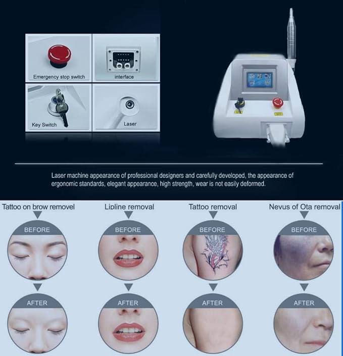 Shape Tactics Precision Picosecond Laser System