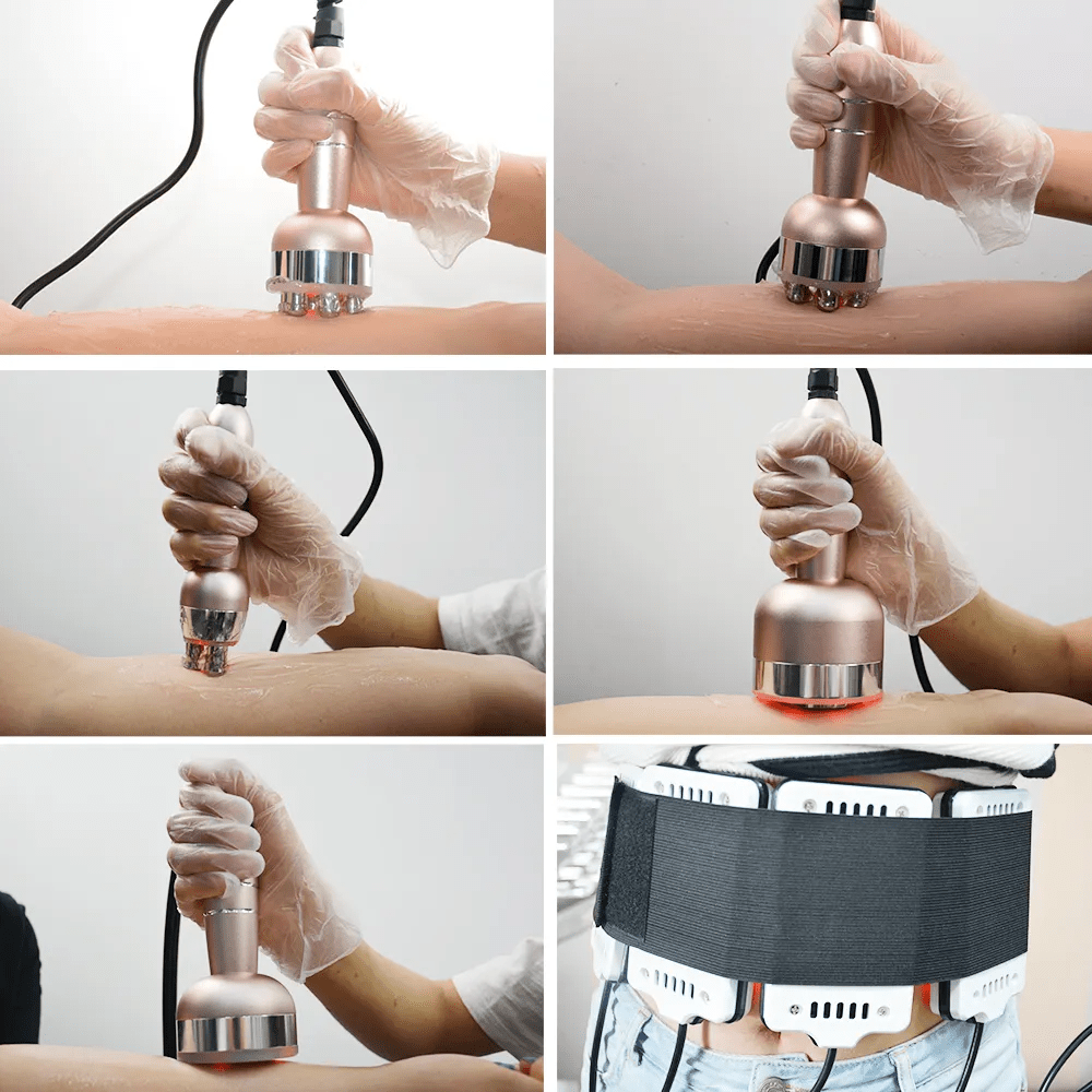 Shape Tactics ProElite 40K RF Lipo Laser System