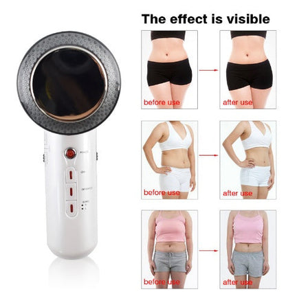Slimming Ultrasound Body Massager Handheld Beauty Device