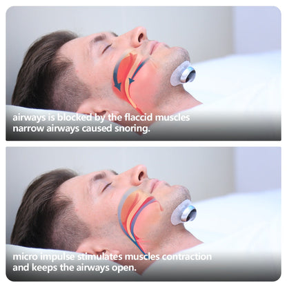Smart Anti-Snoring Device Electronic Muscle Stimulator