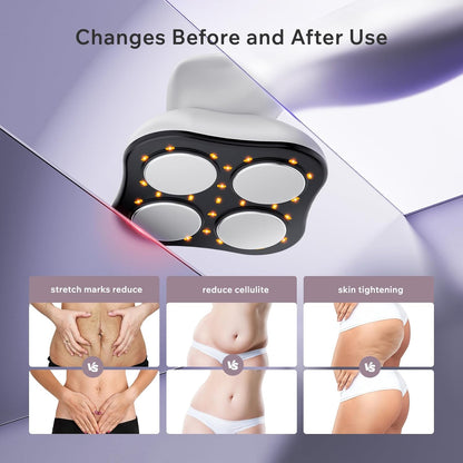 Depsoul Cellulite Massager Body Machine - 3 Modes 10 Levels with Heating Function Electric Massage Machine Body for Leg, Arm, Belly, Waist, Buttocks, Back
