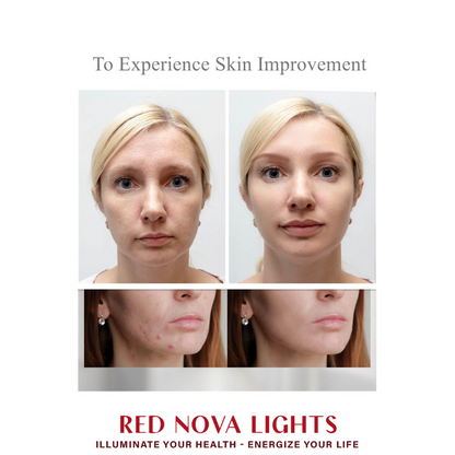 Red Nova Lights LED Face Mask – Red, Blue, Yellow & Near-Infrared Light