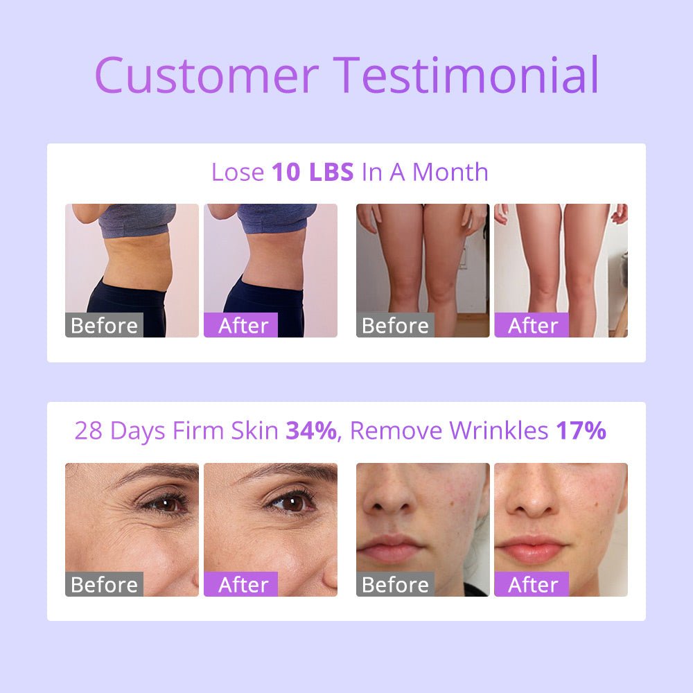 Shape Tactics 6-in-1 30K Cavitation Vacuum Lipo RF