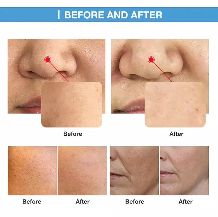 Shape Tactics O+ Skin Care Oxygen CO2 & RF Beauty System