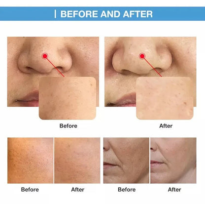 Shape Tactics O+ Skin Care Oxygen CO2 & RF Beauty System