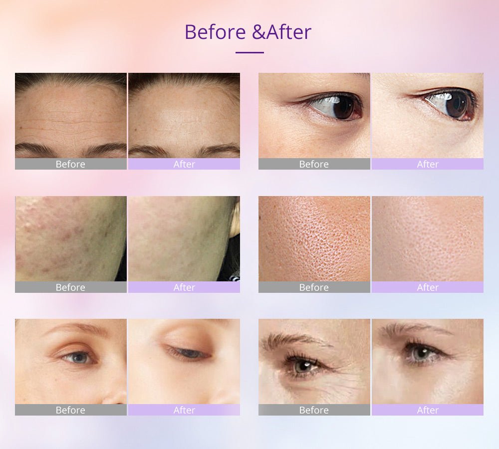 Shape Tactics Photon LED Facial Care Microcurrent Beauty Device