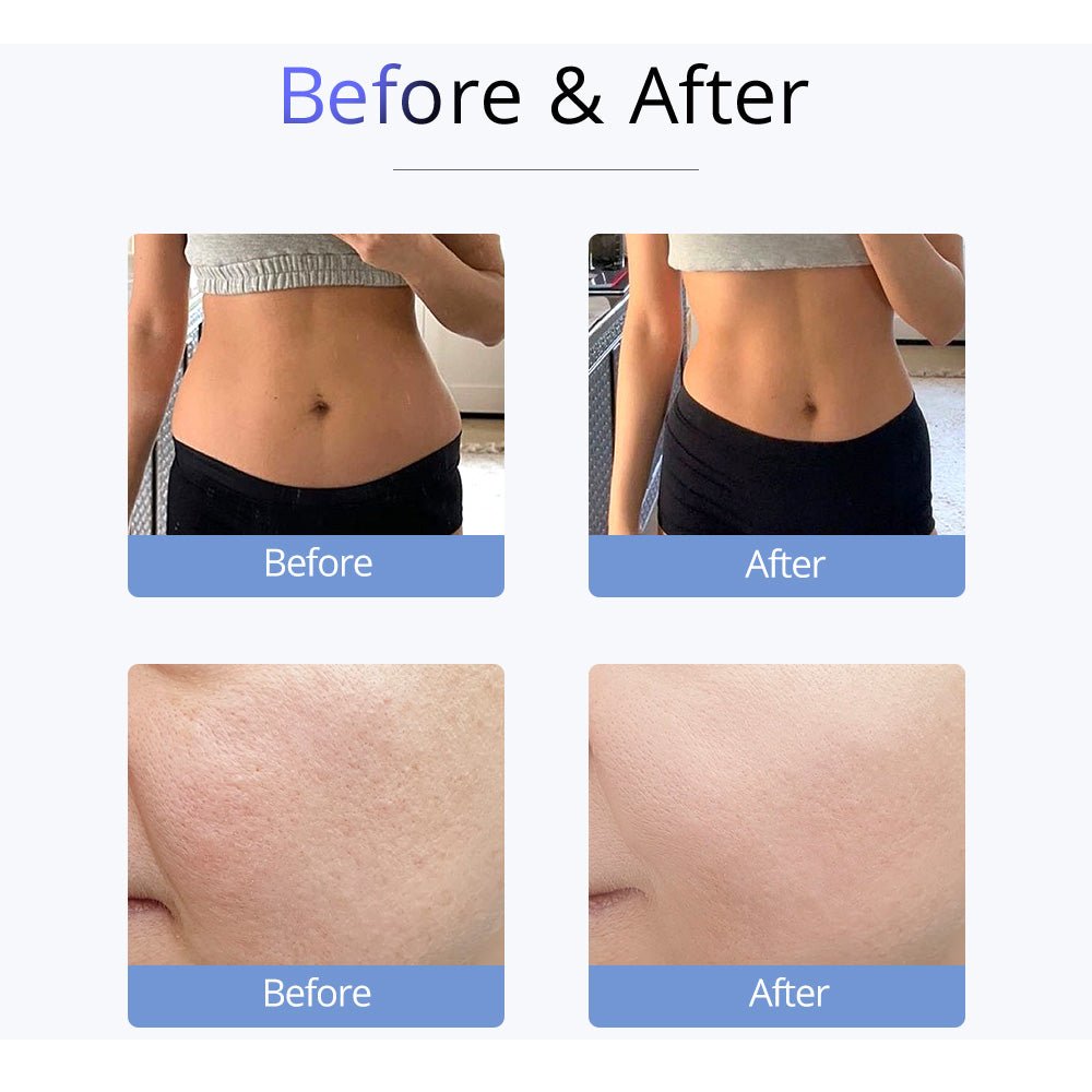 Shape Tactics S-Shape 30K Ultrasonic Cavitation & RF Vacuum Therapy System